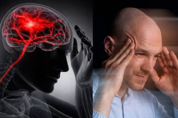 "ब्रेन स्ट्रोक के ये चार मुख्य कारण, नजरअंदाज करना हो सकता है जानलेवा"