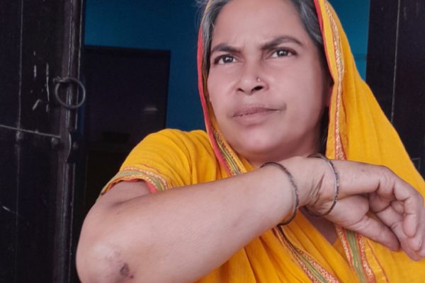 रांची के किशोरगंज चौक पर मॉर्निंग वॉक के दौरान महिला से सोने की चेन और झुमके की लूट।